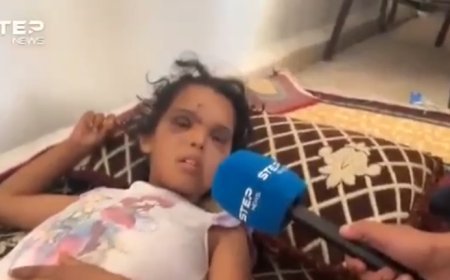 طفلة بدوية تروي ماحصل لها واهلها على يد ميليشيا الهجري